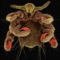 Pubic Lice Under the Microscope
