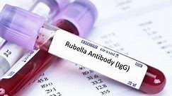 What you need to know about Rubella (IgM and IgG) tests in pregnant women