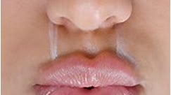 Hermosa Advance Lip Filler Online Training In French