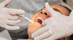 Why Same-Day Emergency Wisdom Teeth Extraction in Temecula