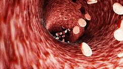 Fat clogs the arteries in the body. LDL. low-density lipoproteins.3d rendering. Chronic non-communicable diseases. Causes of heart disease. Sickness. Dangerous to health.
