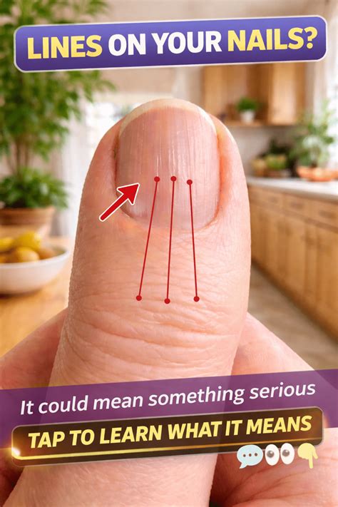 What Do Ridges on Your Nails Mean? Your Easy-to-Read Guide to Vertical, Horizontal, and Dark ...