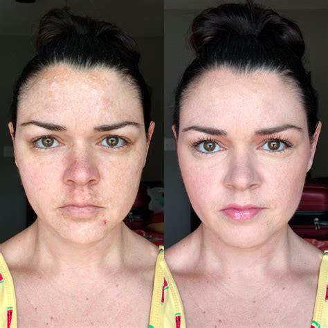 Best Full Coverage Makeup For Melasma | Makeupview.co