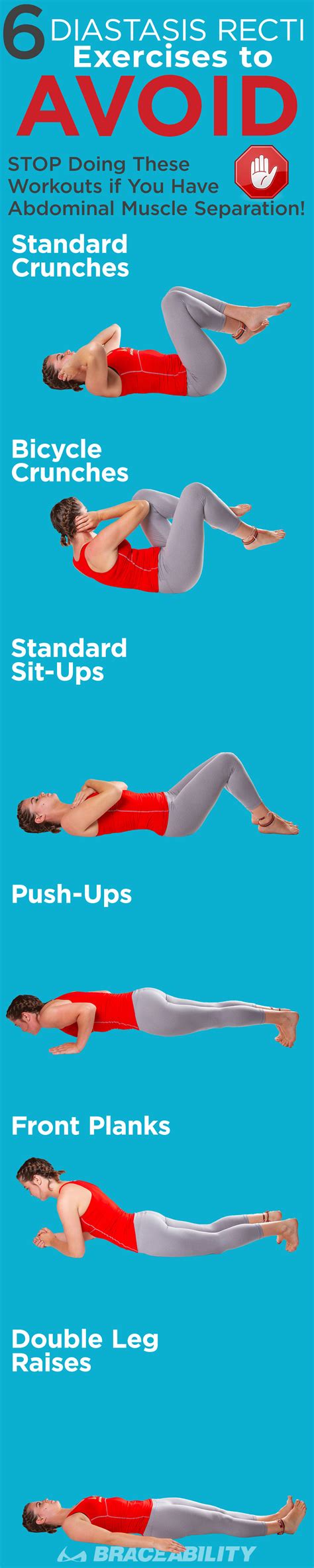 A Complete Guide to Diastasis Recti: Truths on Abdominal Separation