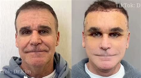 Dr. Kim Plastic Surgeon (TikTok) | Know Your Meme