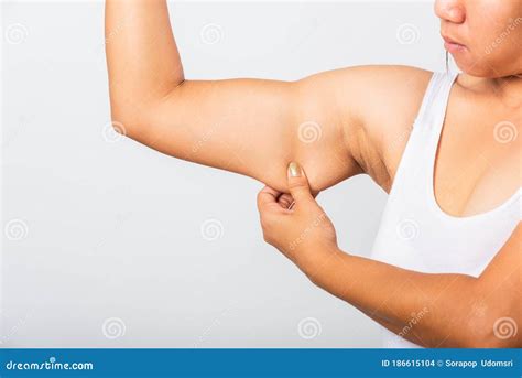 Woman Pulling Excess Fat on Her Under Arm, Problem Armpit Skin, Studio ...