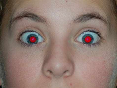 Fine Beautiful Info About How To Treat A Red Eye - Bluegreat57