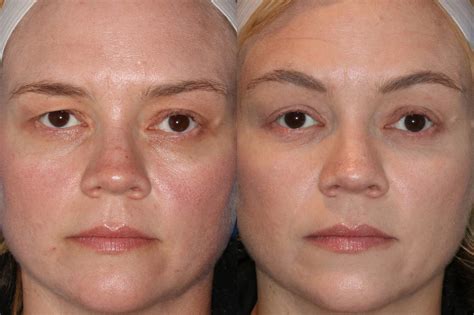 Eye Health Nw Oregon City