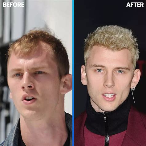 Before and After Results - Capital Hair Center