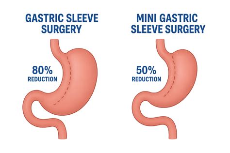 Gastric Bypass Reversal: Cost, Recovery, and Outcomes
