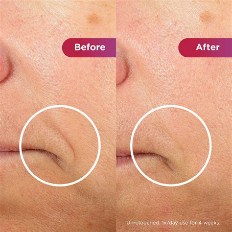 Shark LED Face Mask | Facial Light Therapy - Shark Beauty UK