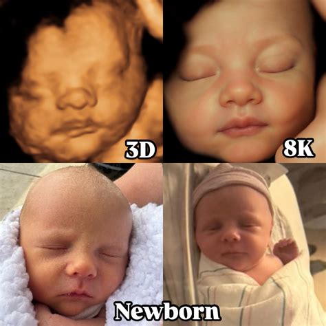 Sweet 3D Baby Ultrasound Studio 🍬 | 3D vs. 8K vs. Newborn 🪄😍 Welcome to ...