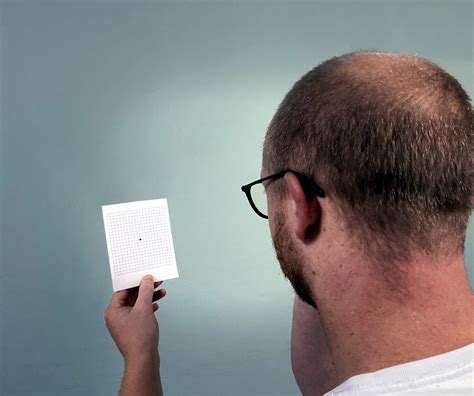 Macular Degeneration Test