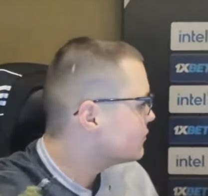 How To Fix Head Dent From Headphones - Ultimate Guide