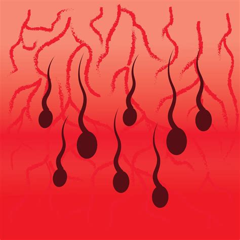 What To Do If You Notice Blood In Your Semen Vasectomy: Treatment