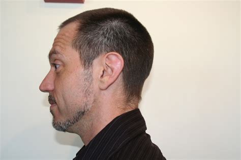 On Stage Hair Design: Nioxin/Rogaine: Does it Really Work?