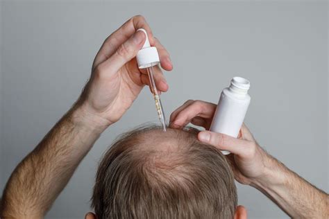 Hair Loss In Adolescence