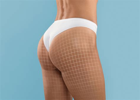 Sculptra® Injections in Ottawa | You Derma