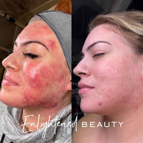 Skin Care Services | Sacramento Esthetician — Enlightened Beauty by ...