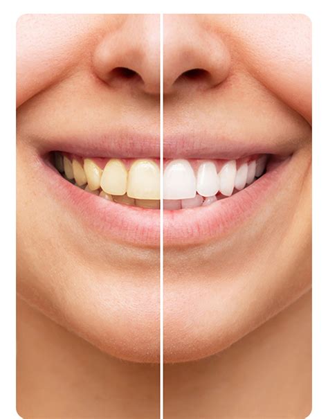 Manchester, NH Dentist Near Me | Aspen Dental