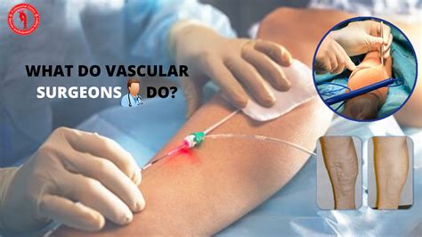 What Is Vascular Access Surgery at Oscar Godson blog