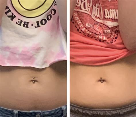 Is my navel piercing healing correctly? I’ve only had it a 1 week 1/2 ...