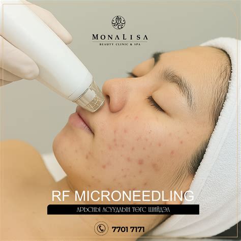Mona Lisa Beauty Clinic Spa (@monalisa_clinic_) • Instagram photos and ...