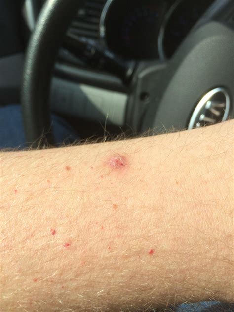 Scar/wound that won't heal?? : SkincareAddiction