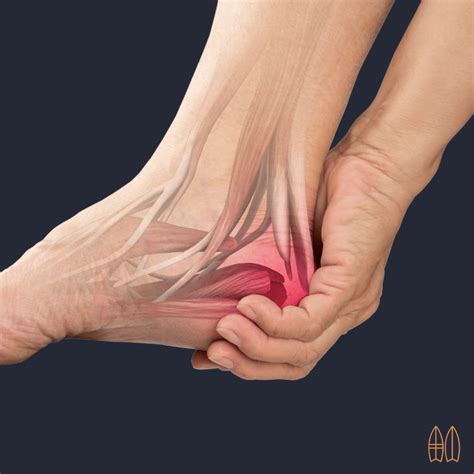 Heel Pain - Matt Hart Bowen Therapy - Ocean Grove, Victoria