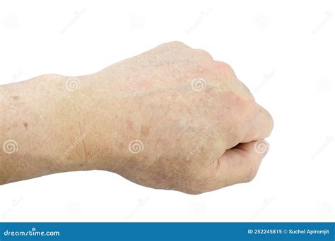 Age Spots On Hands Of Man. Liver Spots, Brown, Black Or Sun Spots Stock Image | CartoonDealer ...