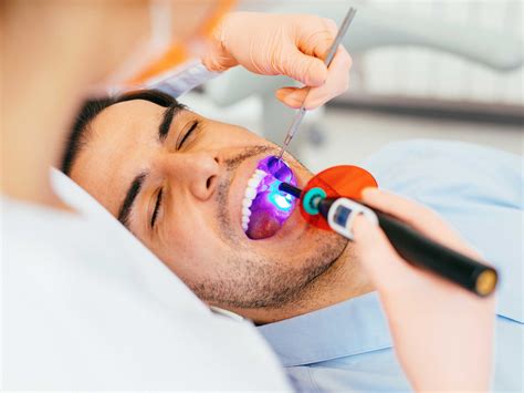 Dental Fillings Procedure