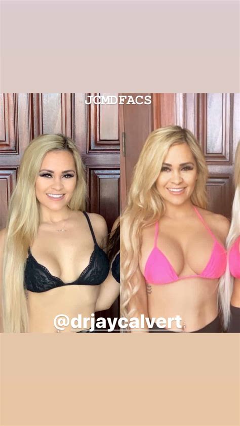 Natural Breast Enlargement Fat Transfer