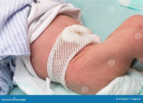 How To Take Care Of Infant Navel at Peter Jacobs blog