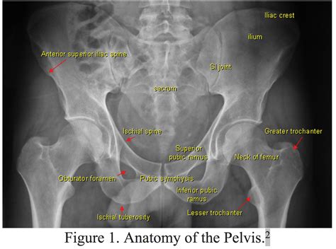 emDOCs.net - Emergency Medicine EducationPelvic fractures: ED ...