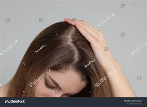 69 Bald Spots Adolescent Royalty-Free Images, Stock Photos & Pictures ...