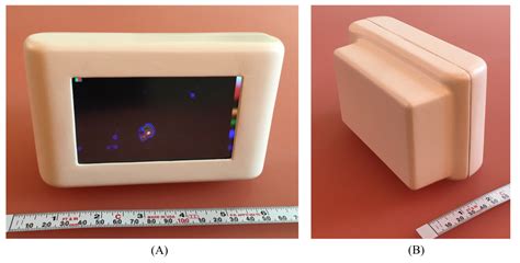 Intraoperative Gamma Cameras: A Review of Development in the Last Decade and Future Outlook