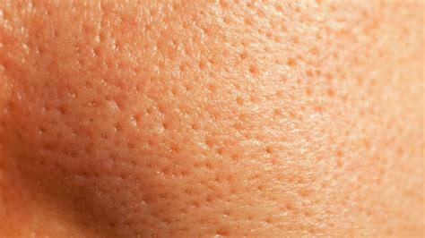 How To Get Rid Of Pores: Tips & Products To Shrink Your Pores | Glamour UK