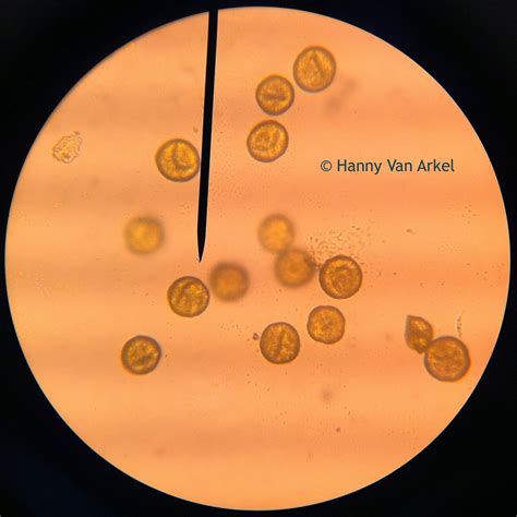 Pollen Under Microscope 100X at Rosemary Henry blog