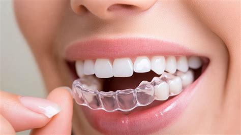 Bite Blocks for Braces: Uses, Types & How They Work