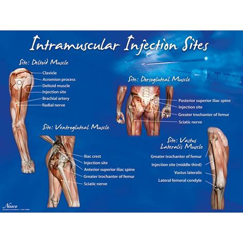 Intramuscular Injection Sites Poster | 1018427 | W44783 | Nasco ...