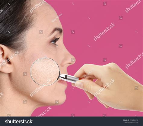 Mature Woman Dry Skin Visiting Dermatologist库存照片1714360198 | Shutterstock