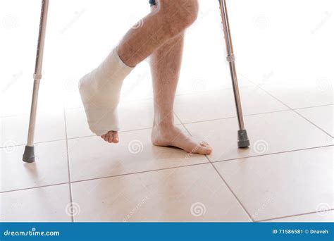 Best Crutches For Broken Ankle at Evan North blog