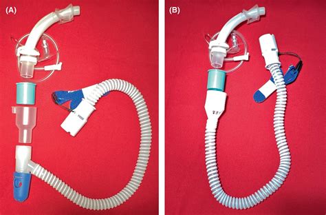 High‐flow via a tracheostomy tube and speaking valve during weaning from mechanical ventilation ...