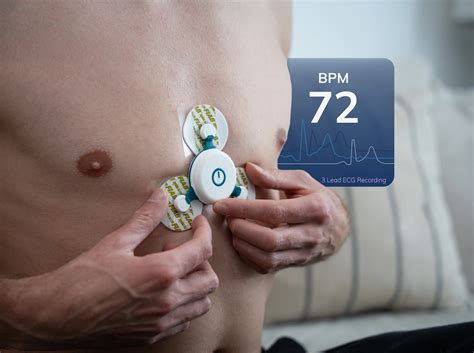 Best At Home ECG Holter Monitor from £225 - HeartTec Solutions