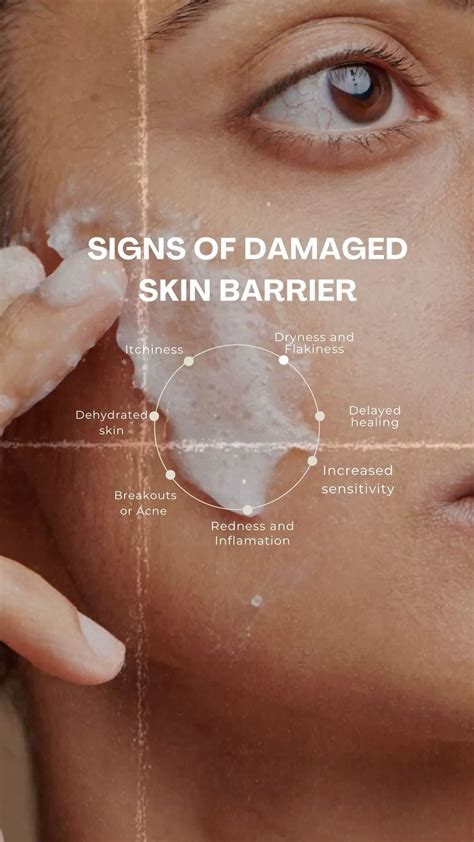 Signs of a Damaged Skin Barrier You Shouldn’t Ignore | Skincare Tips | Estetista, Idee, Pelle