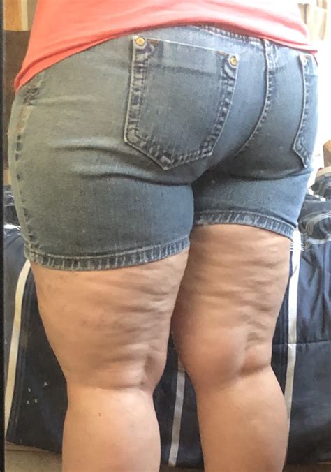 Cottage Cheese Legs
