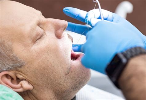 Dental Code For Suture Removal | Dental Suture Manufacturer