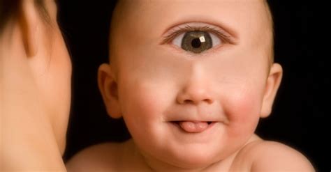 Human Born With One Eye
