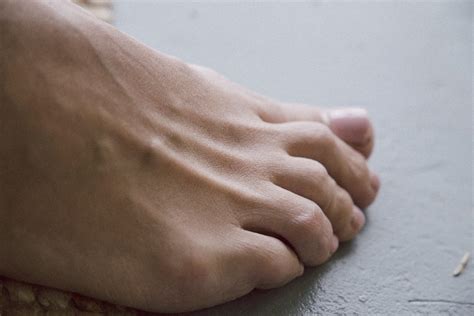 7 Signs of Arthritis in Your Feet - Foot and Ankle Group