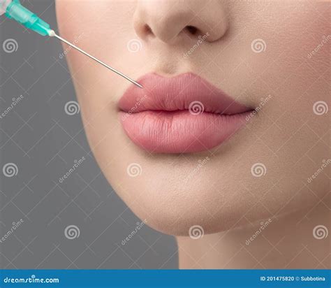 Lips Injections Price at Marcos Hines blog